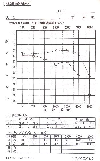 Hearing recovery began with acupuncture, audiogram