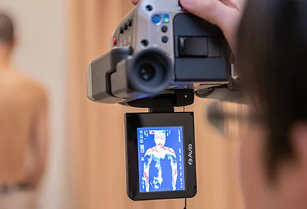 thermography
