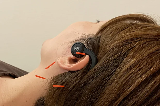 Acoustic Therapy and Acupuncture Scenes