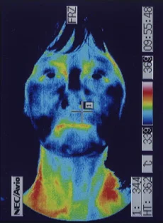 Examine temperature distribution throughout the body