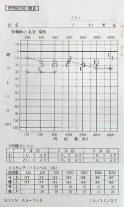 Sudden hearing loss made better by acupuncture