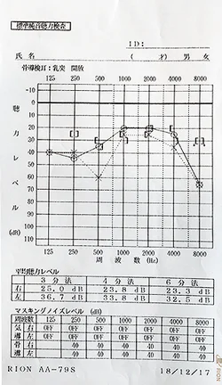 Sudden hearing loss made better by acupuncture