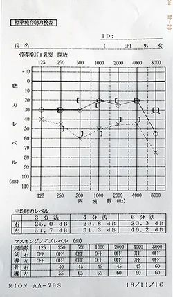 Sudden hearing loss before acupuncture