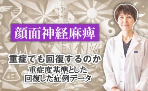 顔面神経麻痺｜重症でも回復する？重症度の基準と回復した症例のデータを基に解説します。