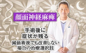 顔面神経麻痺の手術後に症状が残る｜減価術後でも改善しない場合の治療選択肢をこちらで解説します。